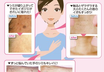 スキンケア,エステ,ヴィオ天神サロン,福岡,美顔,イボ取り